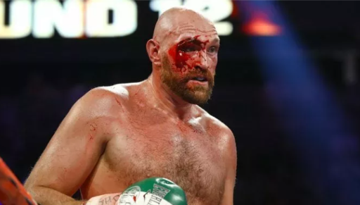 FURY’S CUT GIVES HIM PROBLEMS AGAINST USYK – ‘IT’S GOING TO BE A BLOODBATH’