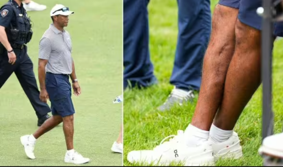 Tiger Woods’ horror car crash injuries on show for first time after near-death ordeal