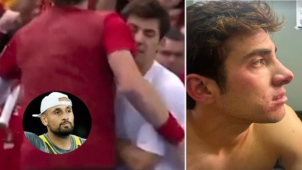 Ależ skandal! Znokautował rywala i decyzją sędziego wygrał. Kyrgios w natarciu